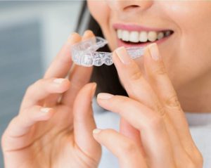 Invisalign-in-Raleigh